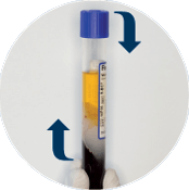 Platelet Resuspension