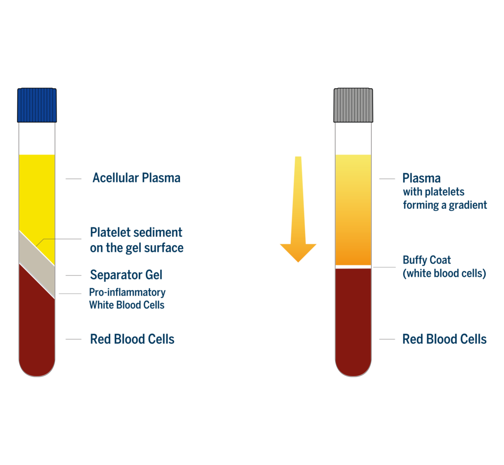 Regen Lab Technology vs.soft spin Technology