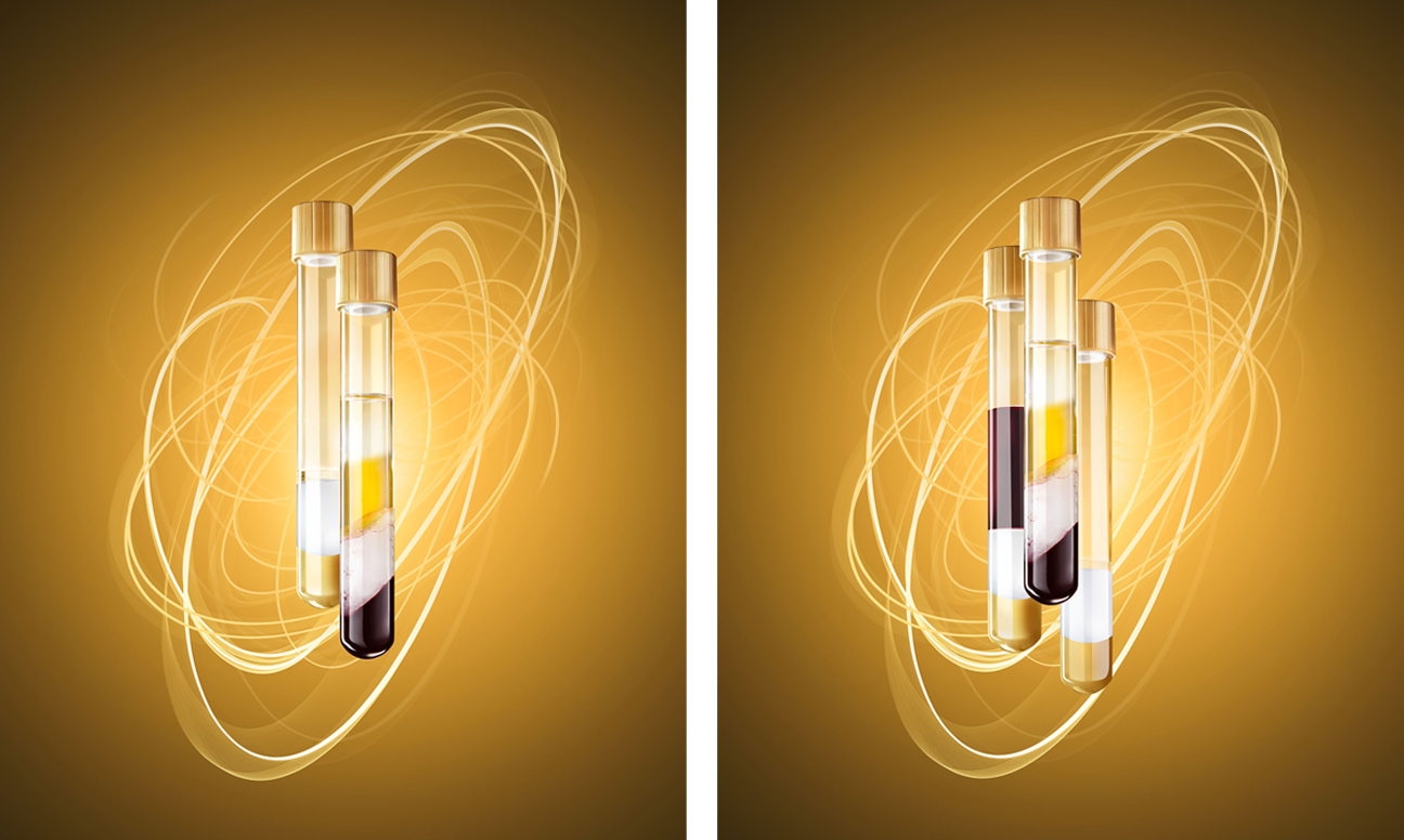 RegenPRP™ in combination with HA