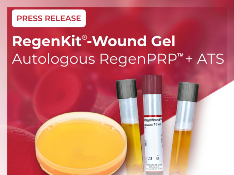 RegenLab USA & MiMedx: Exclusive U.S. Distribution for RegenKit®-Wound Gel
