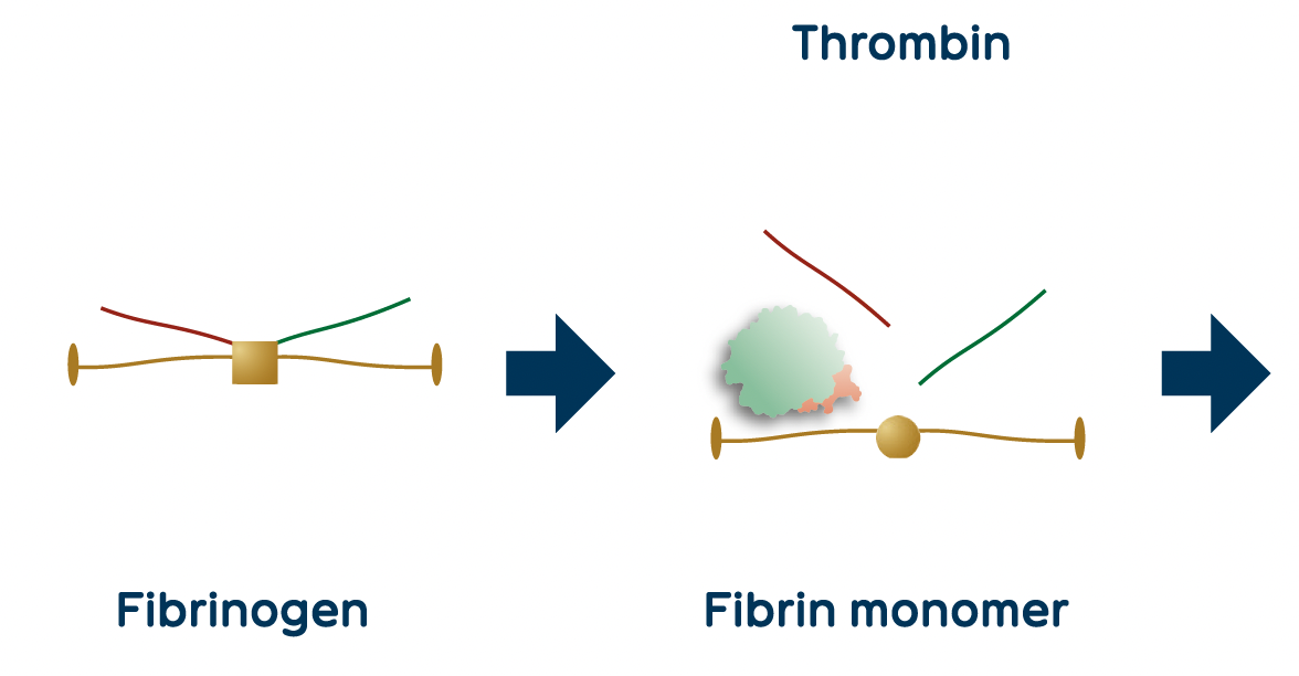 RegenPRP™ in combination with HA
